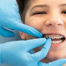 Cost of Braces in 2026 image