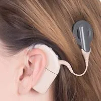 woman wearing cochlear implant